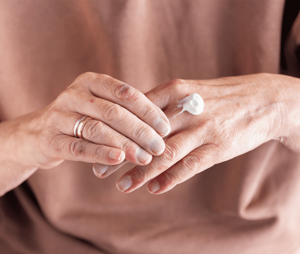 Close up image of elderly woman's hands with arthritis cream waiting to be rubbed in.