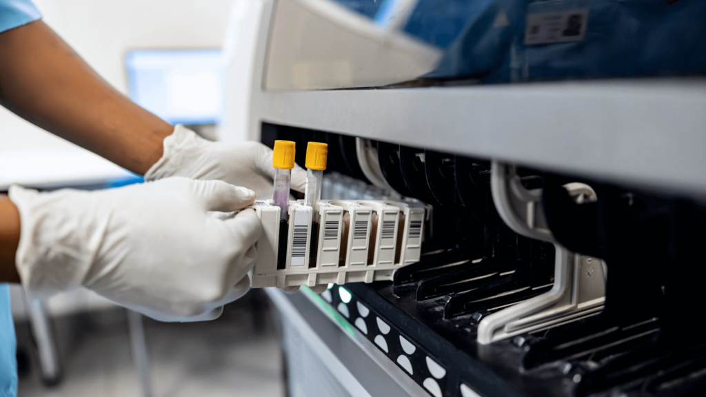A person in white gloves loads blood sample tubes with yellow caps and barcodes into a laboratory machine for analysis.