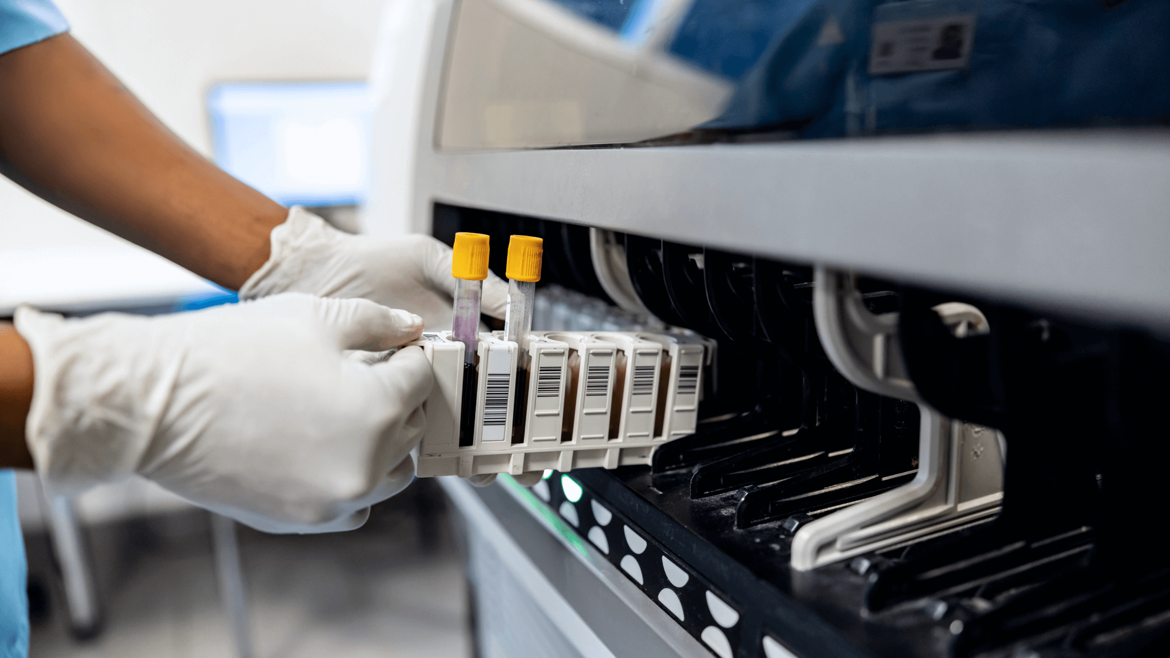 A person in white gloves loads blood sample tubes with yellow caps and barcodes into a laboratory machine for analysis.